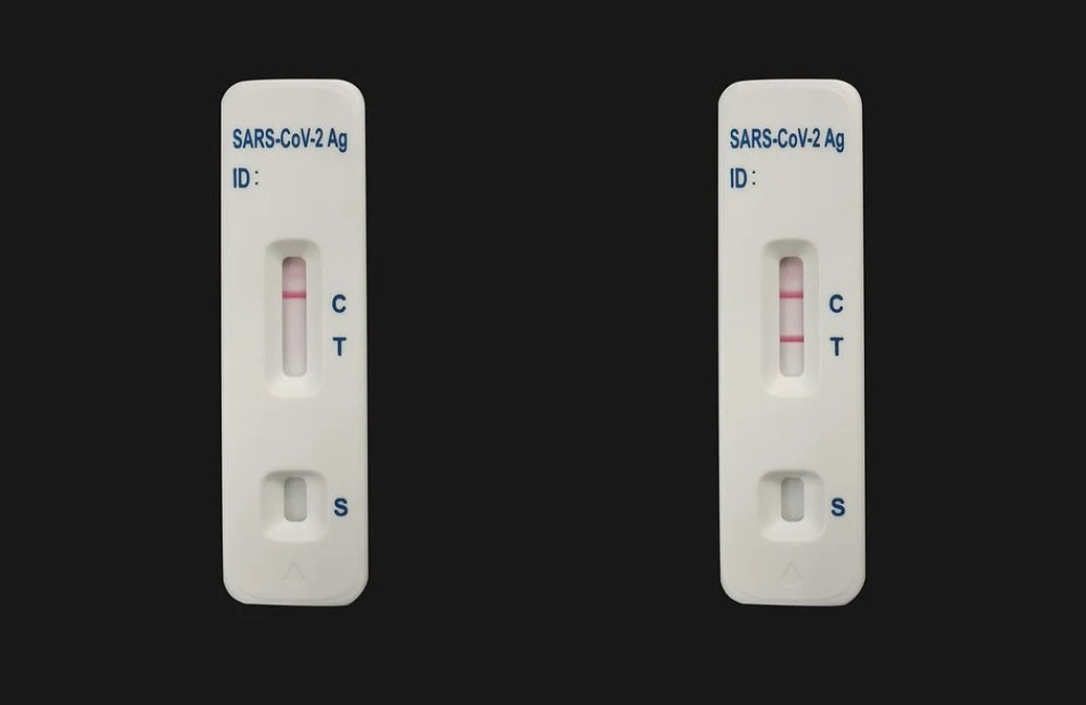 Self test: 30 εταιρείες κατέθεσαν προσφορές