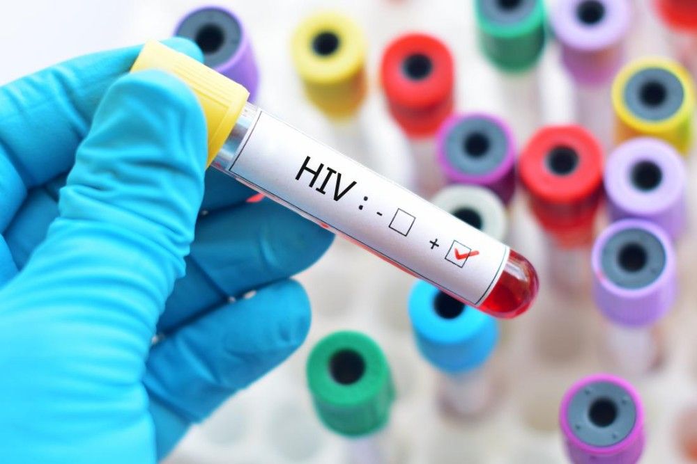 &#8220;Φρένο&#8221; στις διακρίσεις ασθενών από HIV βάζει η κυβέρνηση